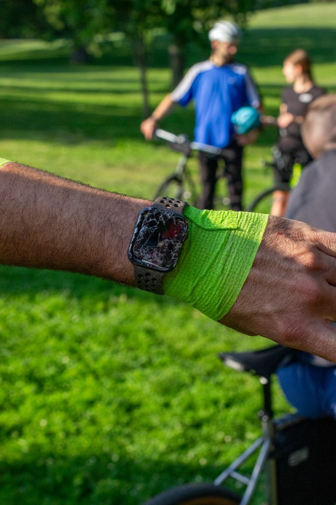 A close-up photo of a cyclist's wrist with a shattered fitness monitor